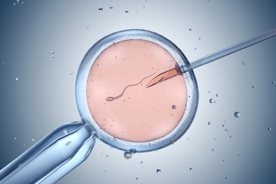 IVF Treatment